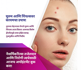 chemical peel